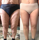 Bastão Botox Bee | Rejuvenescedor